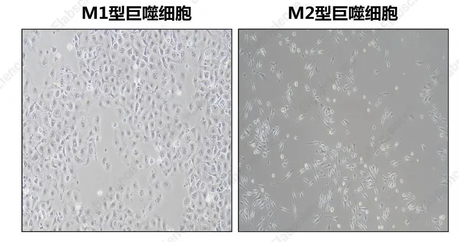 C57小鼠骨髓来源巨噬细胞极化M1和M2形态对比